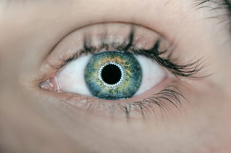 6 Benefits Of LASIK Eye Surgery